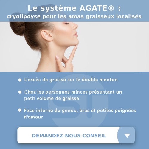 Excès de graisse du double menton éliminé grâce au système AGATE de la cryolipolyse